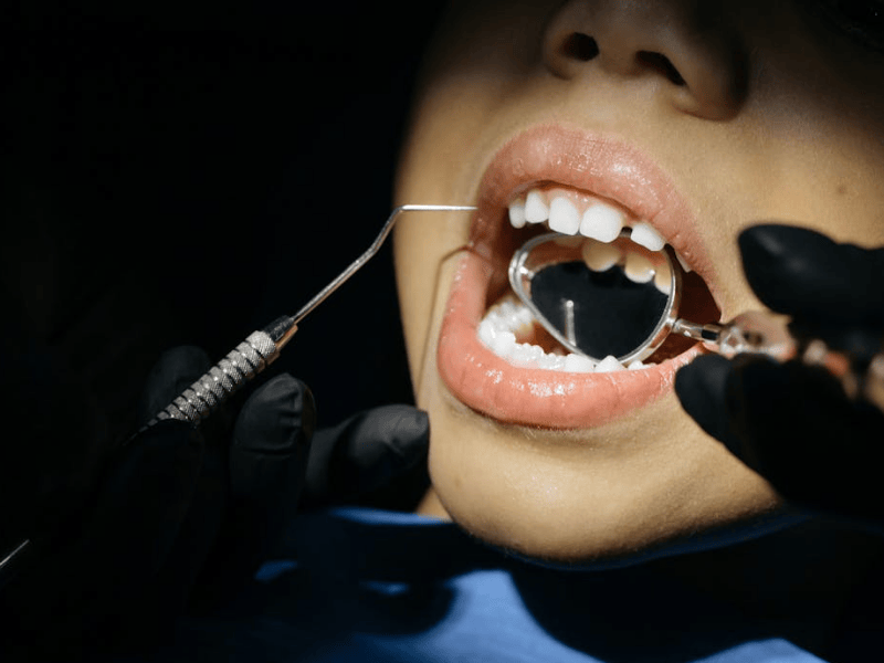 Who-qualifies-for-free-braces
