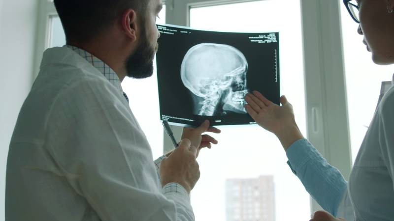 does-medicaid-cover-tms-therapy-1