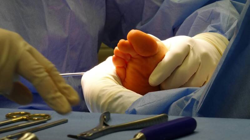 does-medicare-cover-podiatry-1