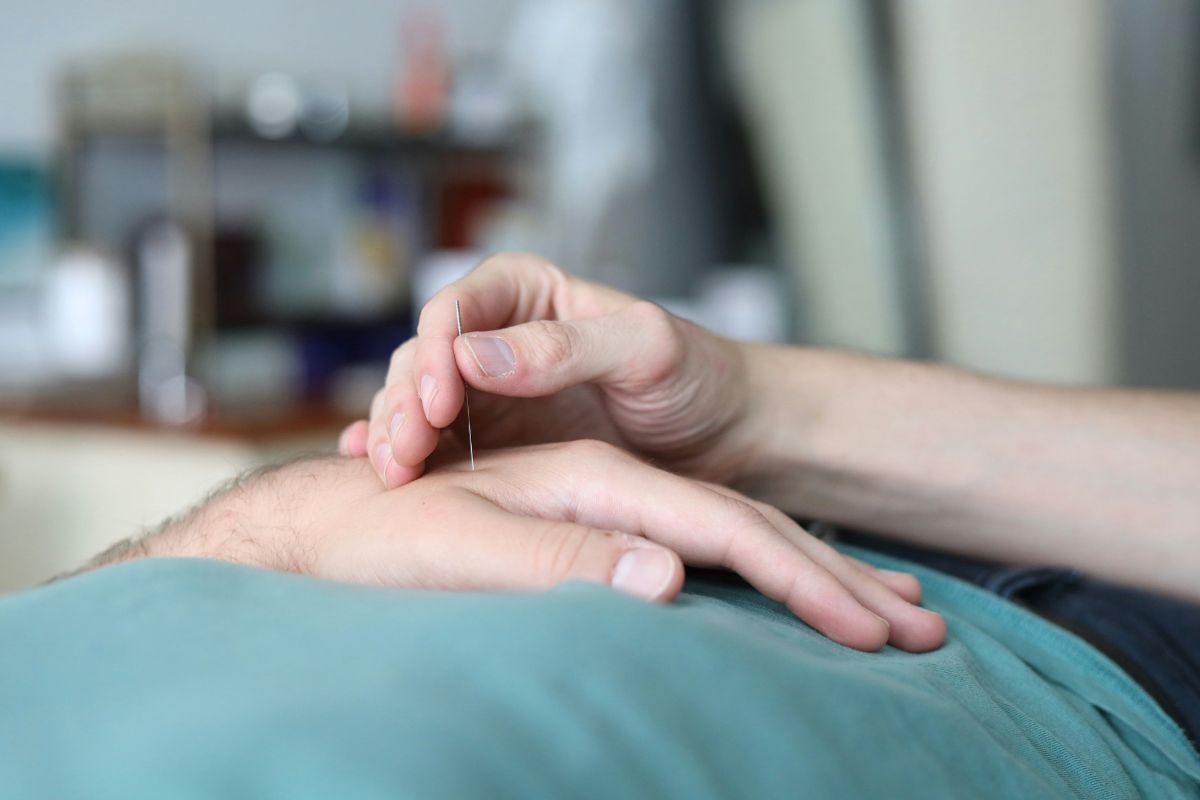 Does Medicare Cover Acupuncture? Expert Advice 2026